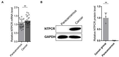 Characterization of the Potential Role of NTPCR in Epithelial Ovarian Cancer by Integrating Transcriptomic and Metabolomic Analysis